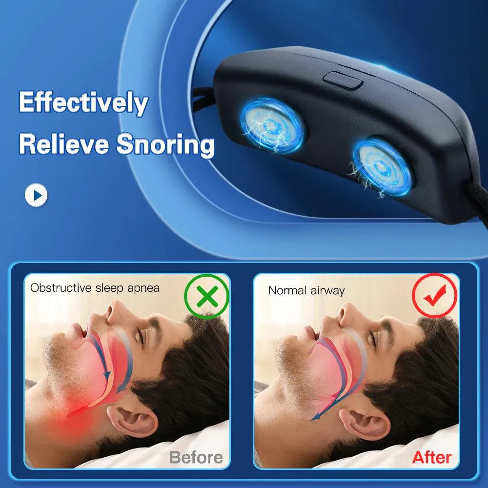 Smart Antisnarkningsenhet med Muskelstimulering – Tystare Sömn & Förbättrad Andning med Vibrationsimpulser